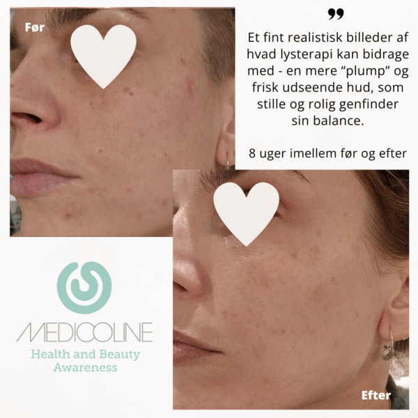 SKINlight PLUS