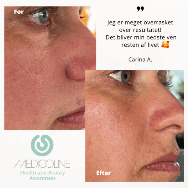 SKINlight PLUS