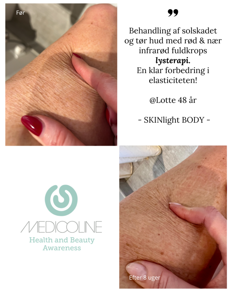 SKINlight BODY